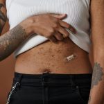 acne friendly hypoallergenic fabrics
